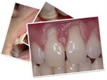 studi dentistici di qualità malattia parodontale 