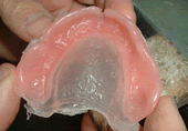 protesi dentale termoadattabile