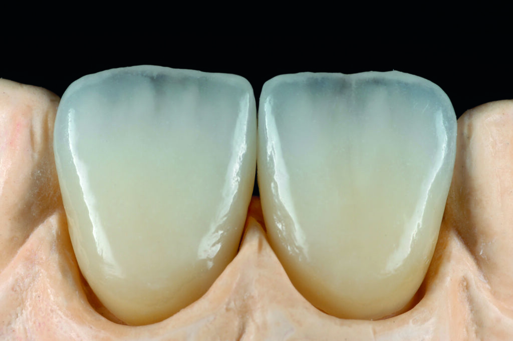 ceramiche zirconio roma