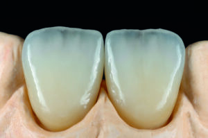 ceramiche dentali roma