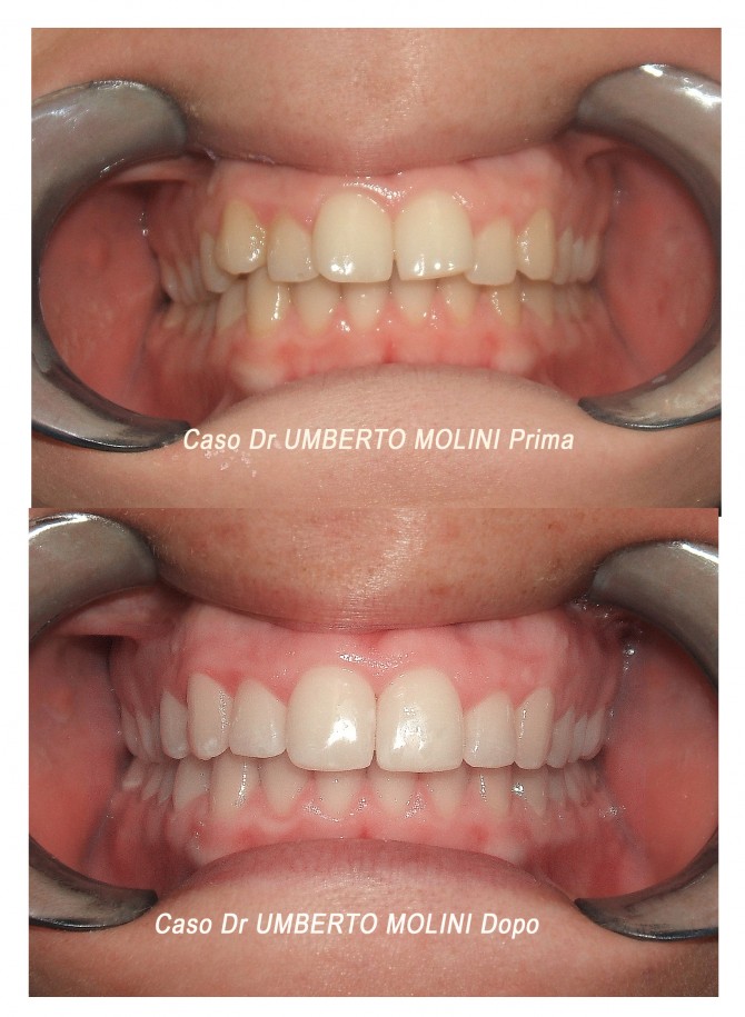 dentista ortodonzia invisibile