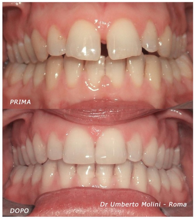 dentista ortodonzia roma 