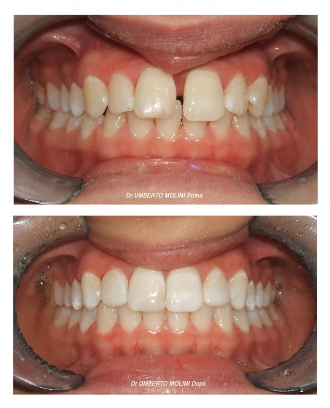 dentista per ortodonzia invisibile