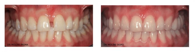 studio dentistico ortodonzia 