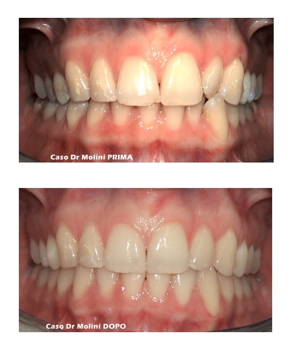 dentista ortodonzia Roma
