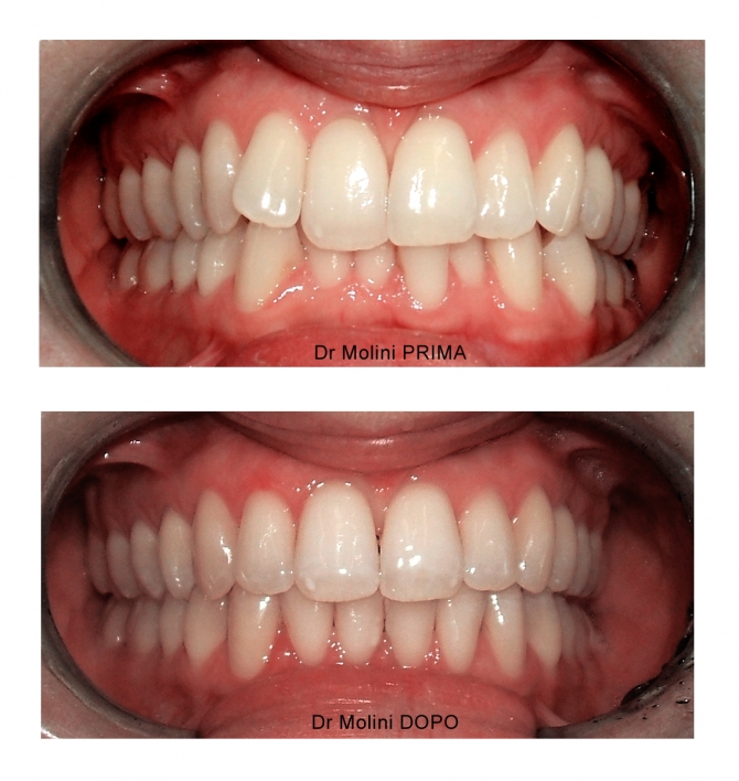 dentista ortodonzia Roma 