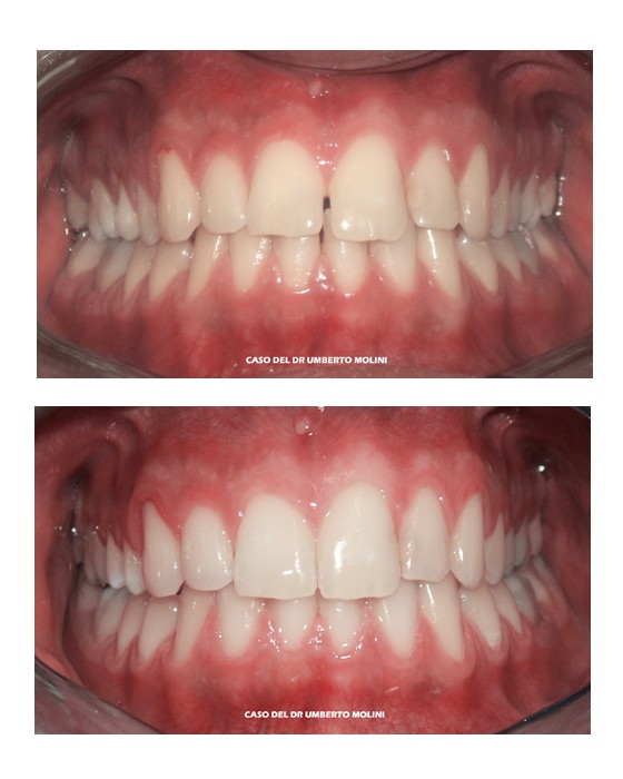 dentista ortodonzia invisibile roma