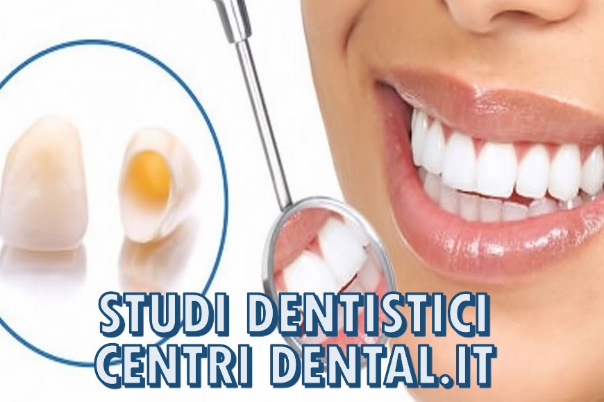 STUDI DENTISTICI DI QUALITA' ROMA CENTRI DENTAL.IT