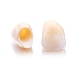 ceramiche dentali studi dentistici roma